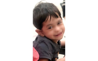 الصورة: الطفلة &laquo;نايا&raquo; تحتاج إلى 14.5 ألف درهم لعلاج تشنجات دماغية