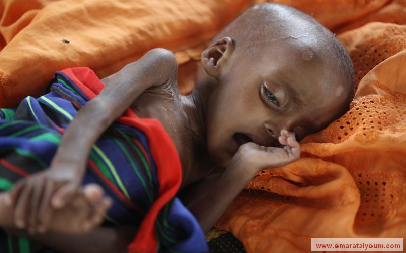 اجتاحت القرن الأفريقي نوبة من المجاعة التي أودت بحياة عدد كبير من أهاليه، وأكدت الإحصائيات أن أكثر من مليوني طفل مهددون بالموت جوعاً - غيتي