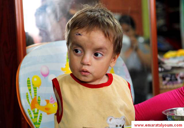 عاهتي هي ذراعي الايمن لمواجة الحياة -رويترز