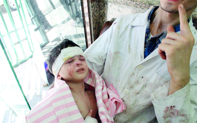 طفل يتلقى العلاج بعد إصابته في قصف نفذته القوات السورية على مدينة حلب.	أ.ف.ب