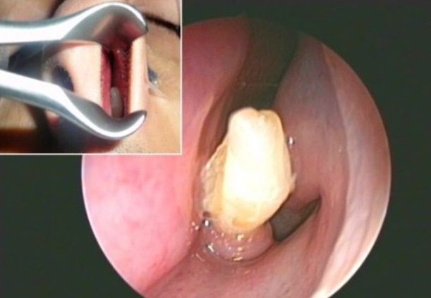 نقلاً عن المصدر