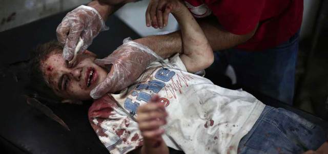 صبي يتلقى العلاج في مستشفى ميداني بعد إصابته بقصف للقوات النظامية على مدينة دوما. أ.ف.ب