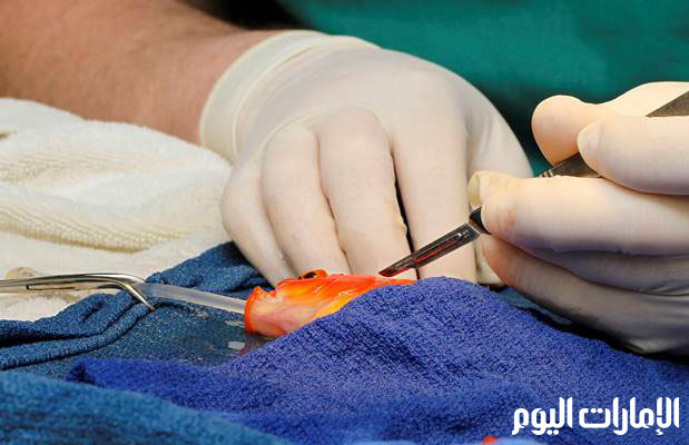 وتم تخدير جورج في دلو من الثلج واستخدم الجراح اسفنجة من الجيلاتين للسيطرة على النزيف في جراحة دامت 45 دقيقة.