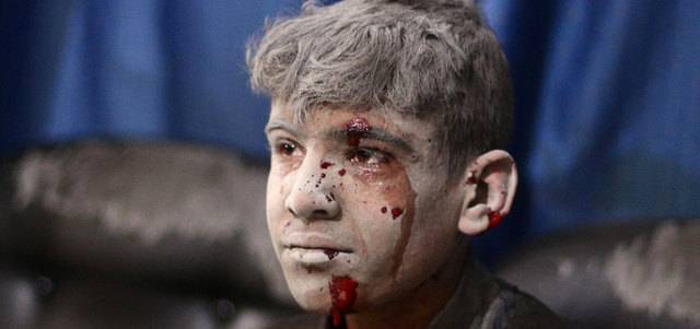 صبي ينتظر تلقي العلاج في مستشفى ميداني بعد إصابته بقصف للقوات النظامية على مدينة دوما بريف دمشق.  أ.ف.ب