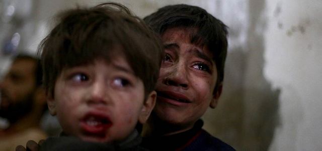 طفل يحتضن شقيقه خلال انتظارهما لتلقي العلاج في مستشفى مؤقت بعد إصابتهما بغارة للقوات النظامية على مدينة دوما. أ.ف.ب