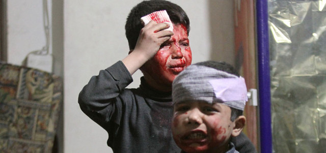 طفلان يعالَجان في مستشفى ميداني بعد إصابتهما بقصف لقوات النظام على دوما.  رويترز