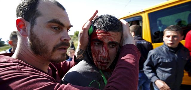 فلسطيني أصيب في المواجهات مع الاحتلال بالقرب من نابلس. أ.ف.ب