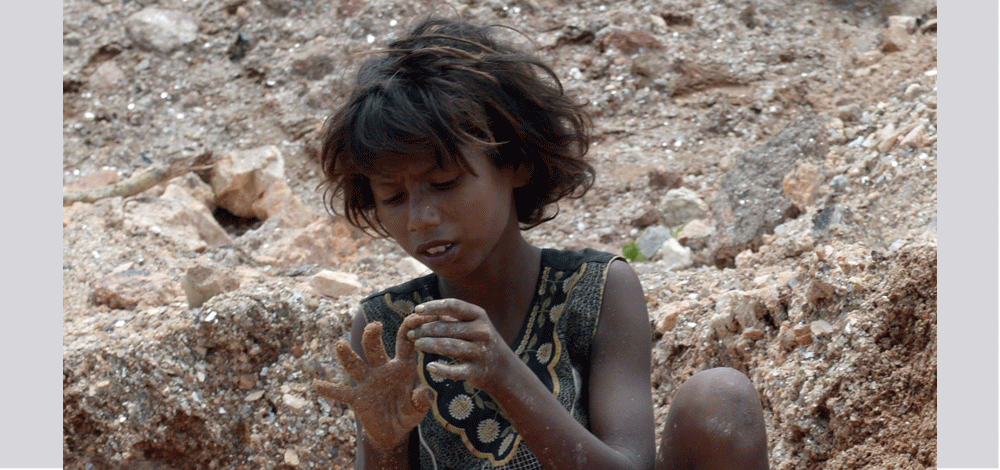 طفلة تتفقد إصبعها بعد تعرضها بالخطأ لضربة بالمطرقة أثناء العمل