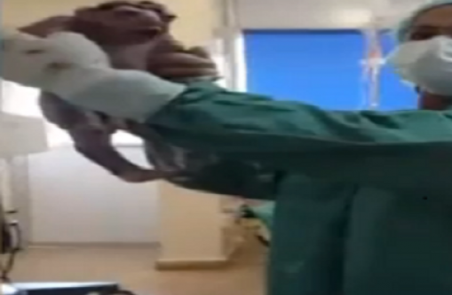 شاهد بالفيديو.. أول ولادة لطفل على شكل ضفدع في الشرق الأوسط