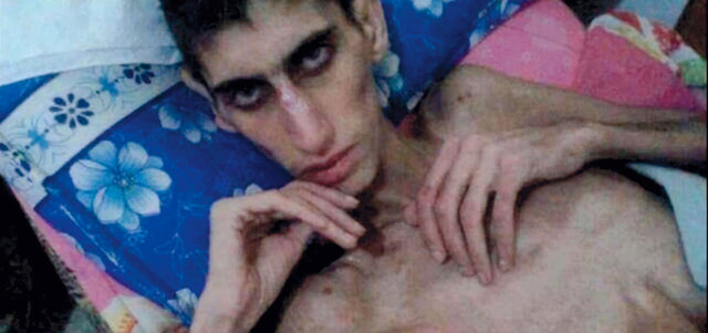 غالبية اهالي مضايا المحاصرين فقدوا 15 كيلوغراما من وزنهم في المتوسط. أرشيفية