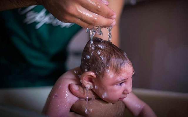 أصبح اسم (Aedes aegypti - باللاتينية) أو الزاعجة المصرية أو بعوضة الحمى الصفراء يؤرق كل النساء الحوامل اللاتي يخشين إصابتهن بقرصة بعوض قد تشوه الجنين وبخاصة رأس الجنين المصاب حيث يكون أصغر من الحجم الطبيعي. الصور: إي بي أيه