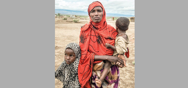 «عائشة» مع طفلتها التي تعاني سوء تغذية بالغ الخطورة. من المصدر