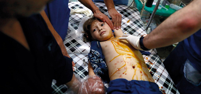 طفلة تتلقى العلاج بالمستشفى بعد قصف النظام لبلدة دوما. أ.ف.ب