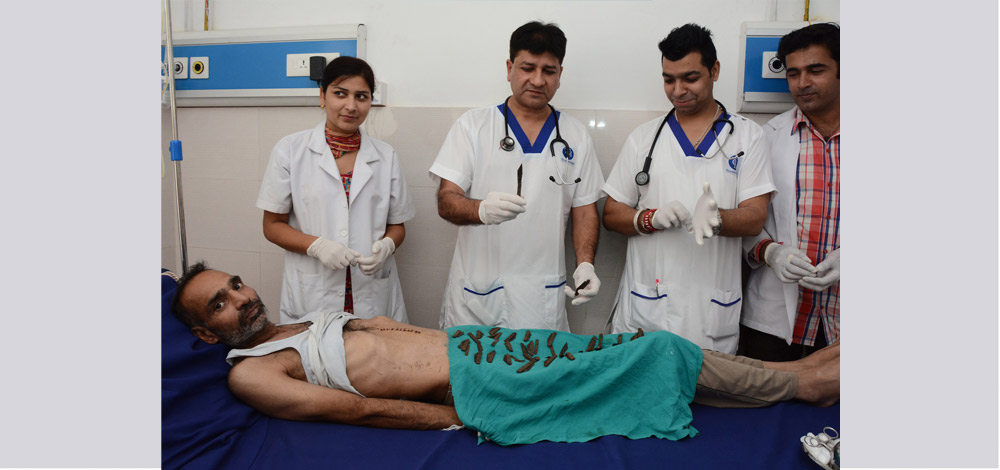 سنغ مع السكاكين التي ابتلعها. إي بي أيه