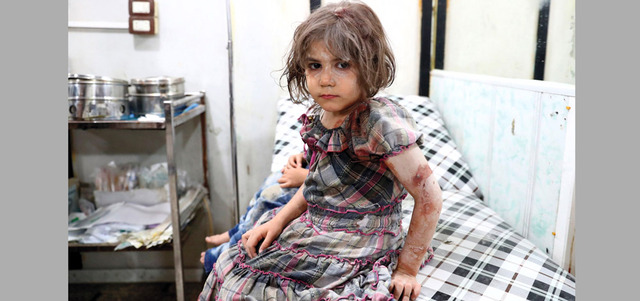 طفلة تنتظر العلاج في مستشفى ميداني بعد إصابتها بقصف للنظام على دوما. أ.ف.ب