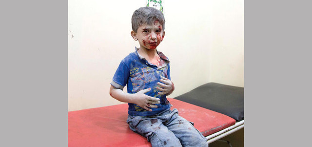 طفل سوري ينتظر العلاج في مستشفى مؤقت بعد إصابته بقصف لقوات النظام على الأحياء الشرقية من حلب. أ.ف.ب