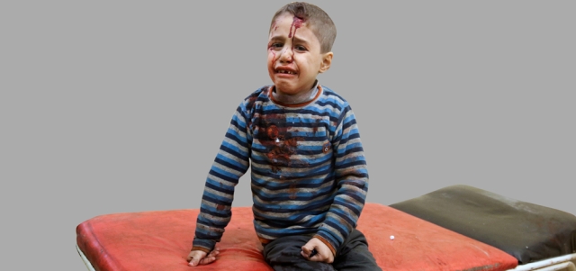 صبي يبكي بعد تلقيه العلاج في مستشفى ميداني إثر إصابته بغارة للنظام على أحياء حلب الشرقية. رويترز