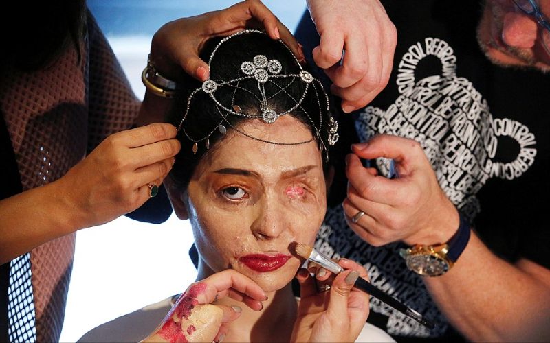 عارضة أزياء تعرضت لاعتداء بالأسيد تضع مساحيق التجميل قبل صعودها على المسرح.الهند.سبتمبر