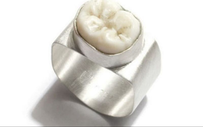 قرر صاحب الهدية التضحية بجزء منه .. فجاءت التضحية على هيئة ضرس يزين الخاتم