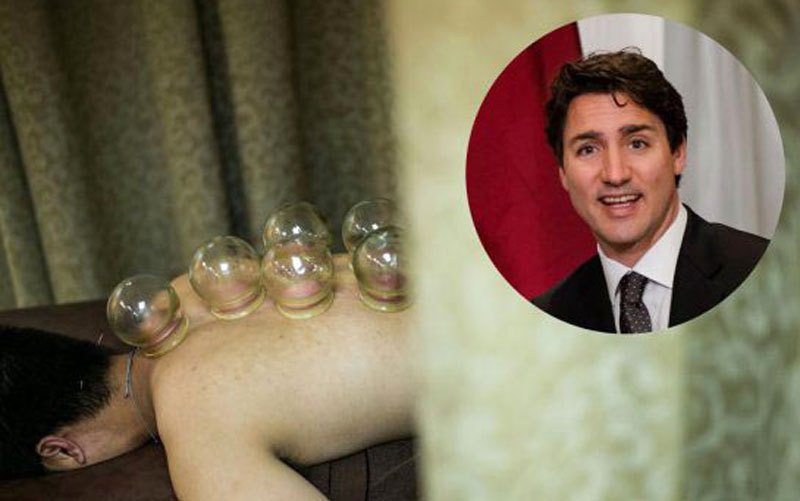 طريقة العلاج بالحجامة تتطلب لصق كؤوس مفرغة من الهواء على مناطق معينة من الجسد لتجميع الدم الفاسد. أرشيفية