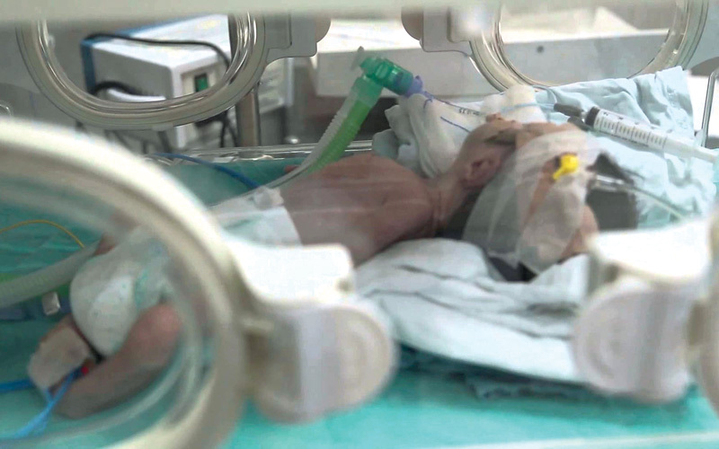 الأطفال الخدّج في غزة يتعرضون لخطر حقيقي بفعل استمرار أزمة انقطاع الكهرباء. الإمارات اليوم