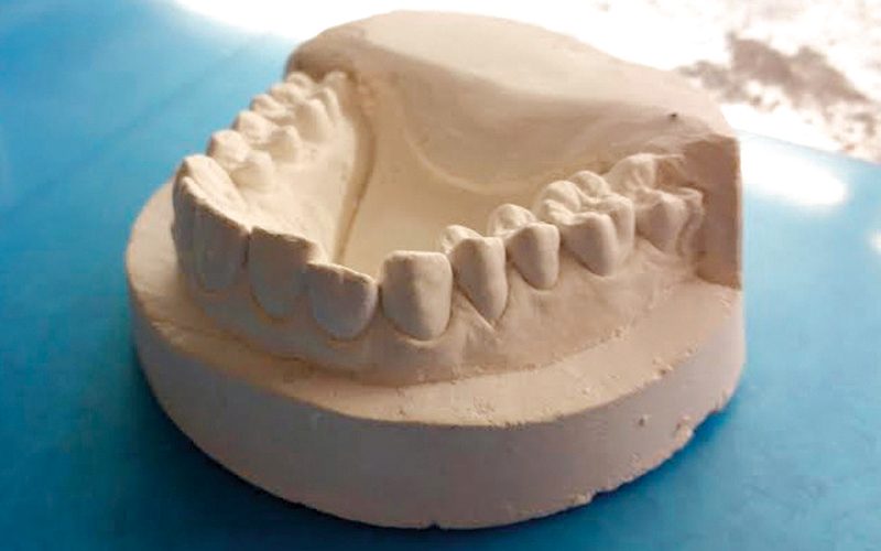 القالب الذي صنعه دودلي تم طباعته باستخدام طابعة ثلاثية الابعاد. من المصدر